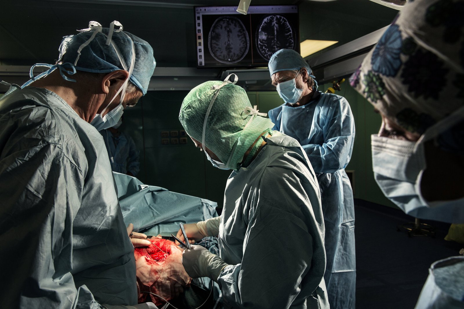 Brain Surgery